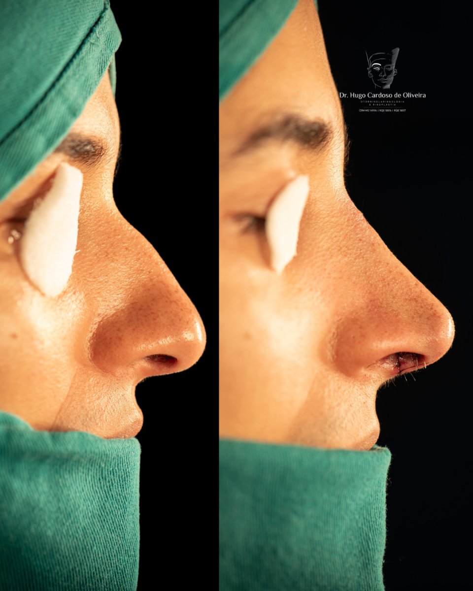 before and after photo