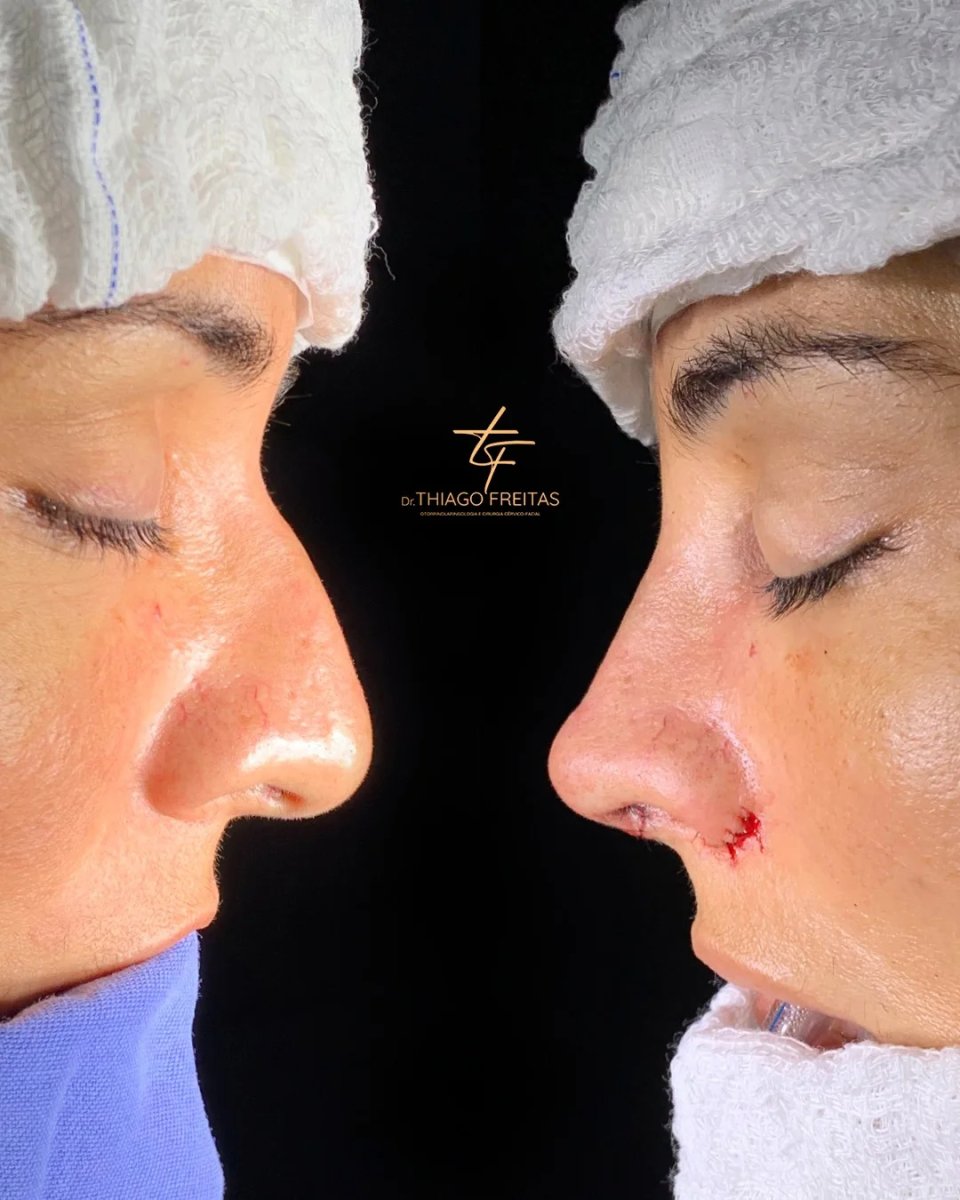 before and after photo