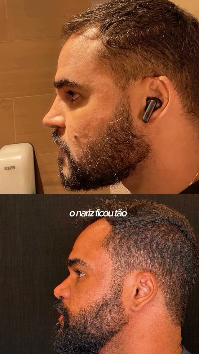 before and after photo