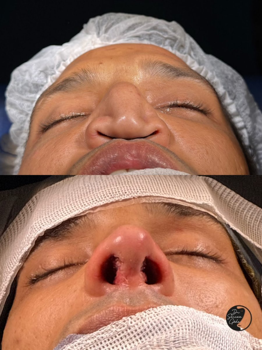 before and after photo