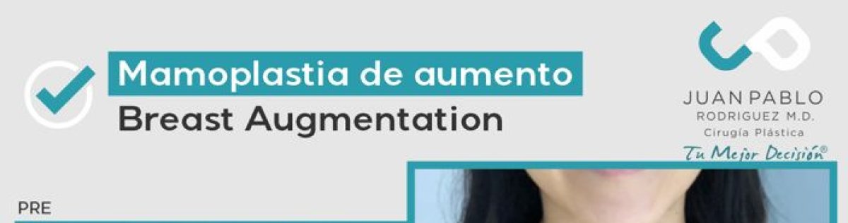 Resultados antes y después de aumento de senos en la clínica Juan Pablo Rodriguez