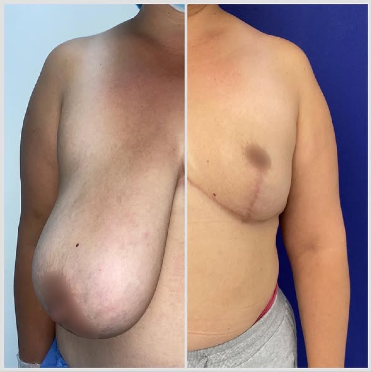 before and after photo