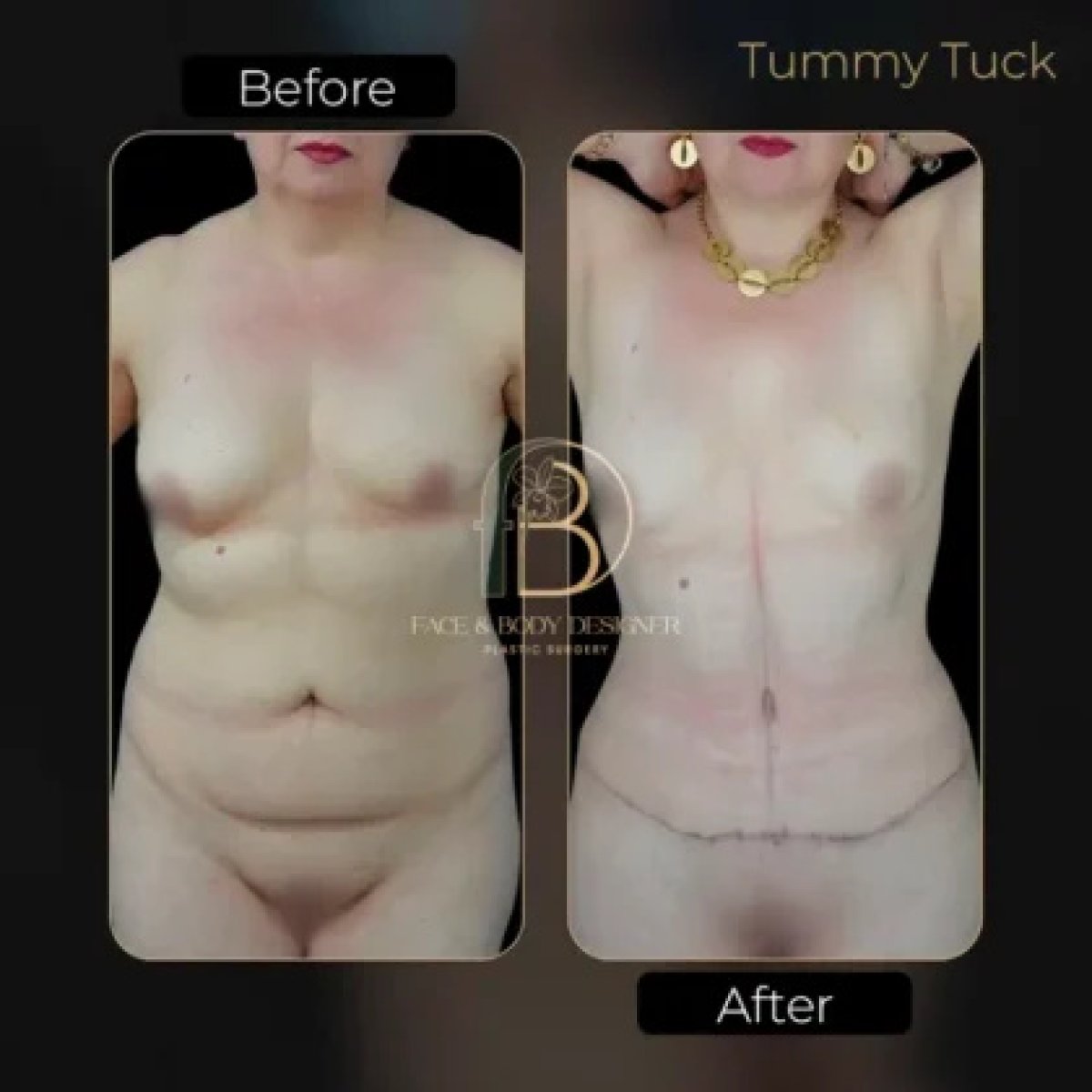 before and after photo