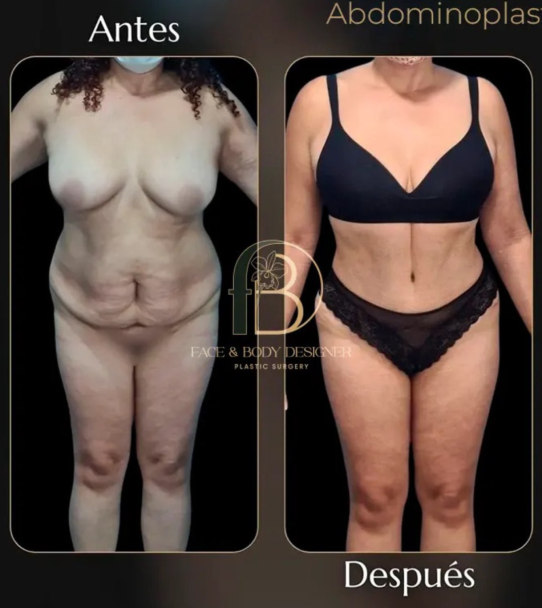 before and after photo