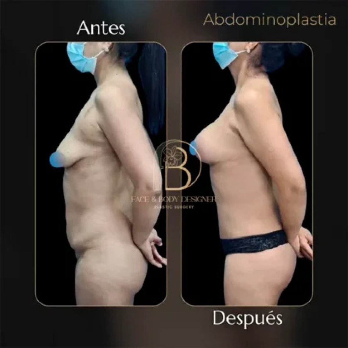 before and after photo