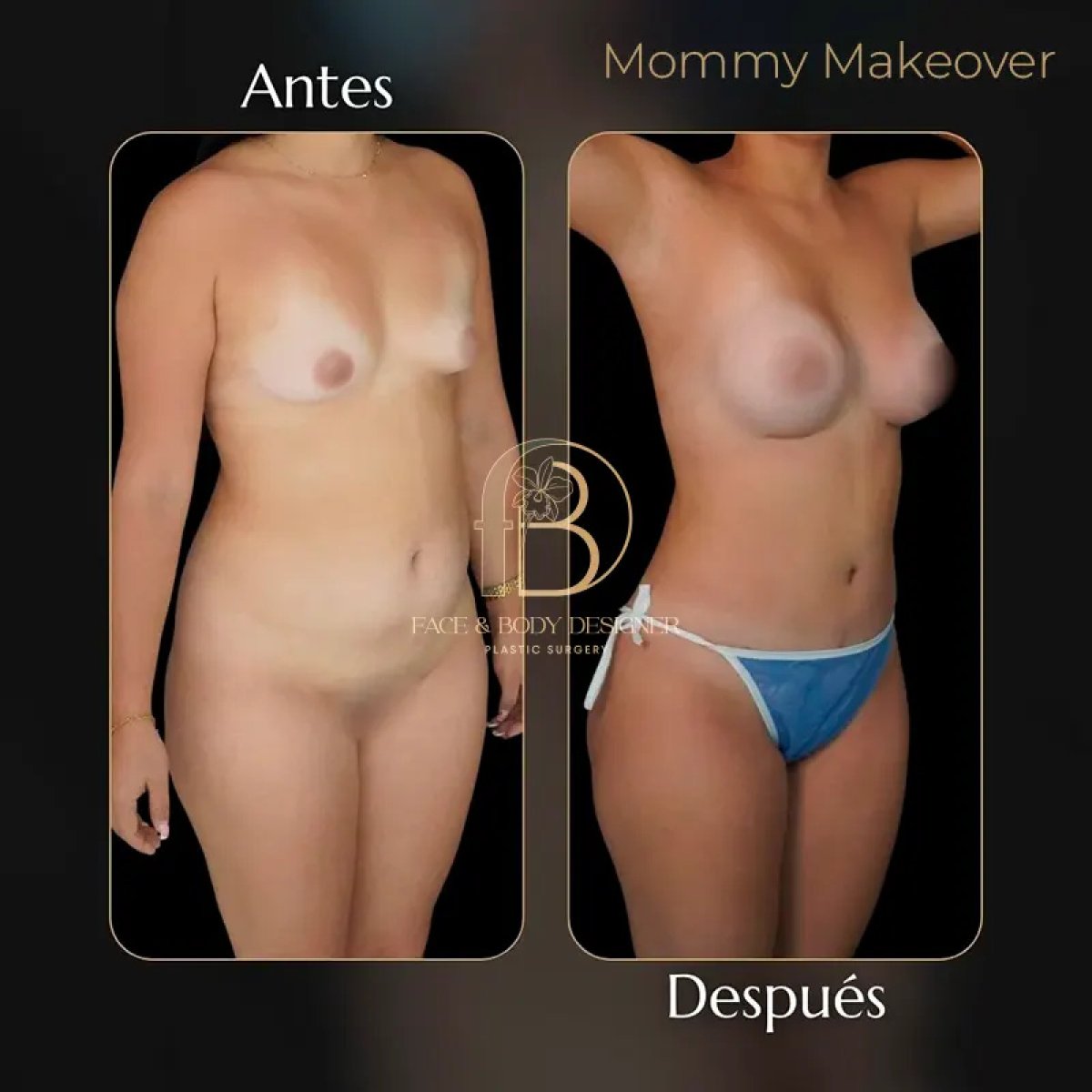 before and after photo