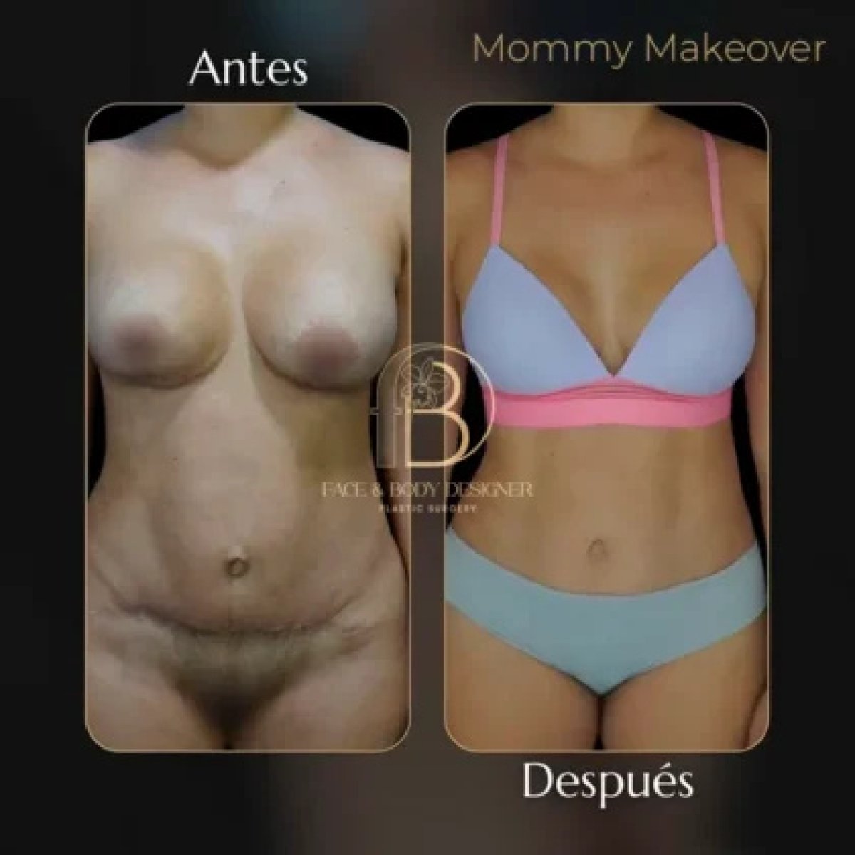 before and after photo
