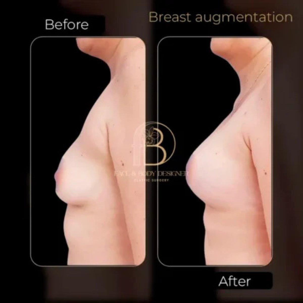 before and after photo