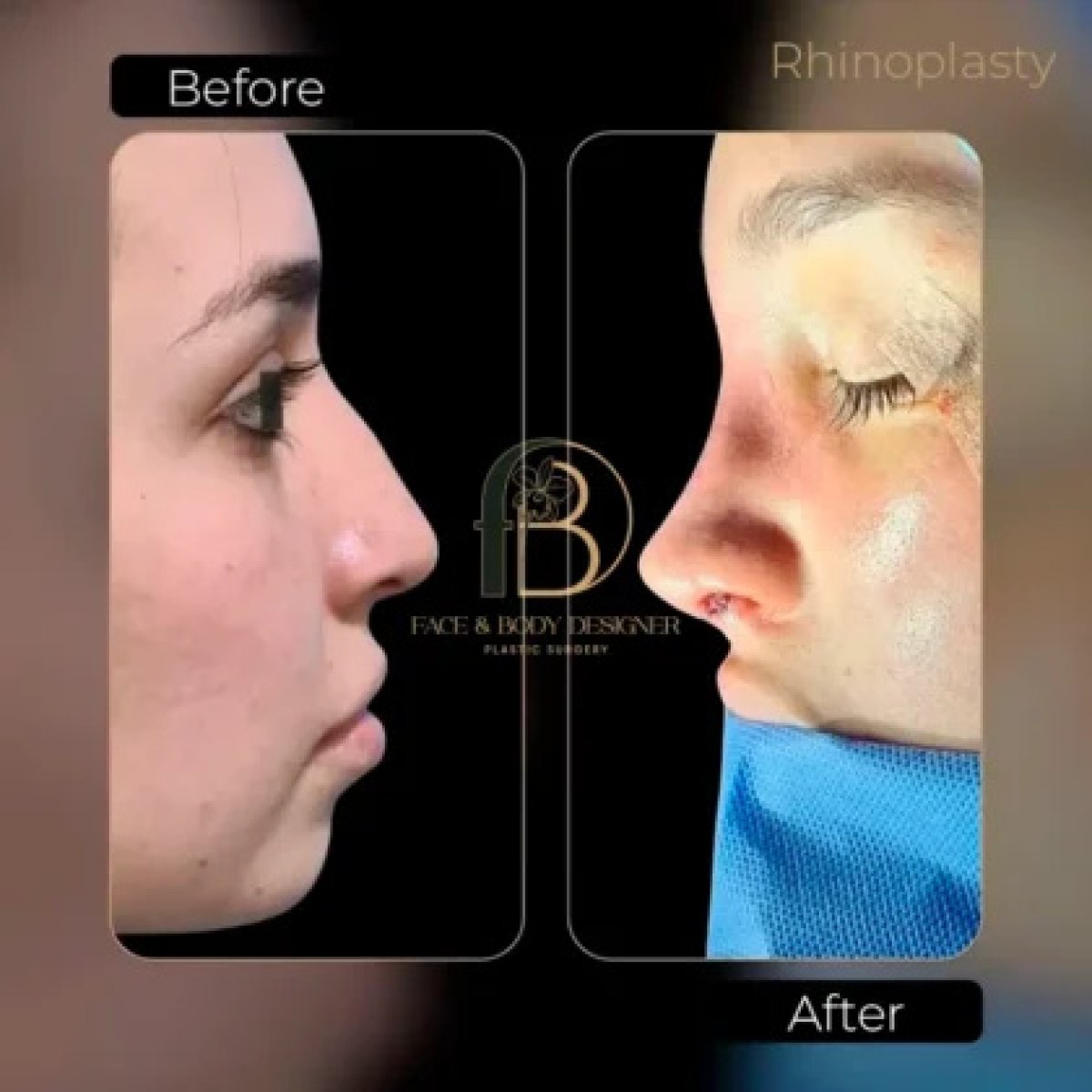 before and after photo