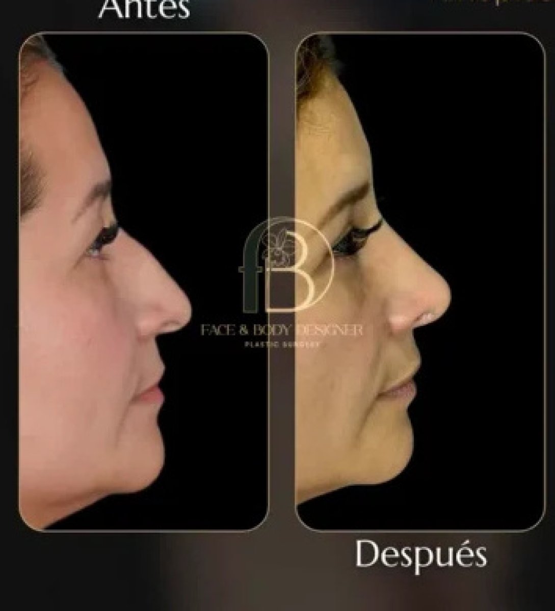 before and after photo