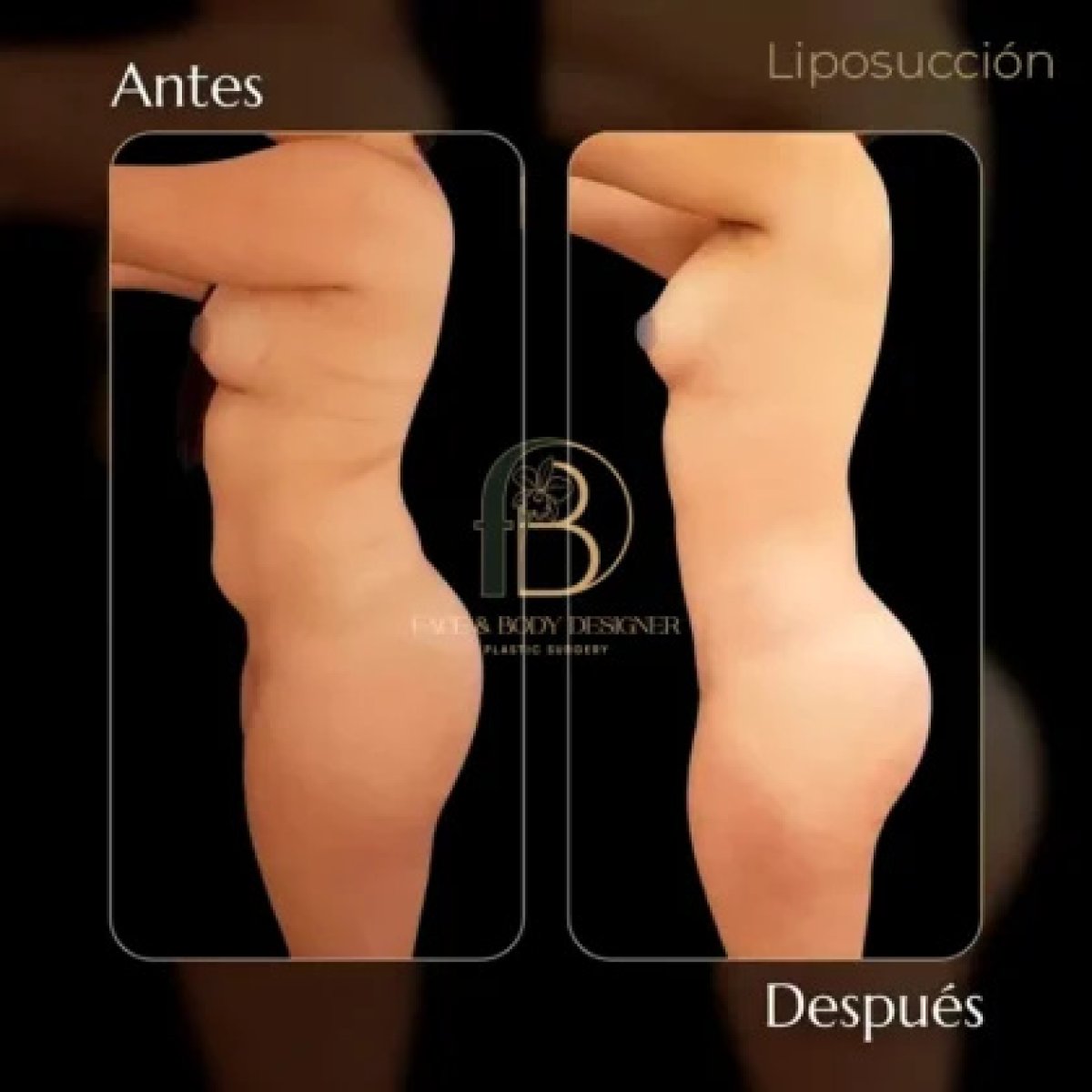 before and after photo