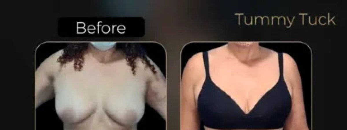 before and after photo