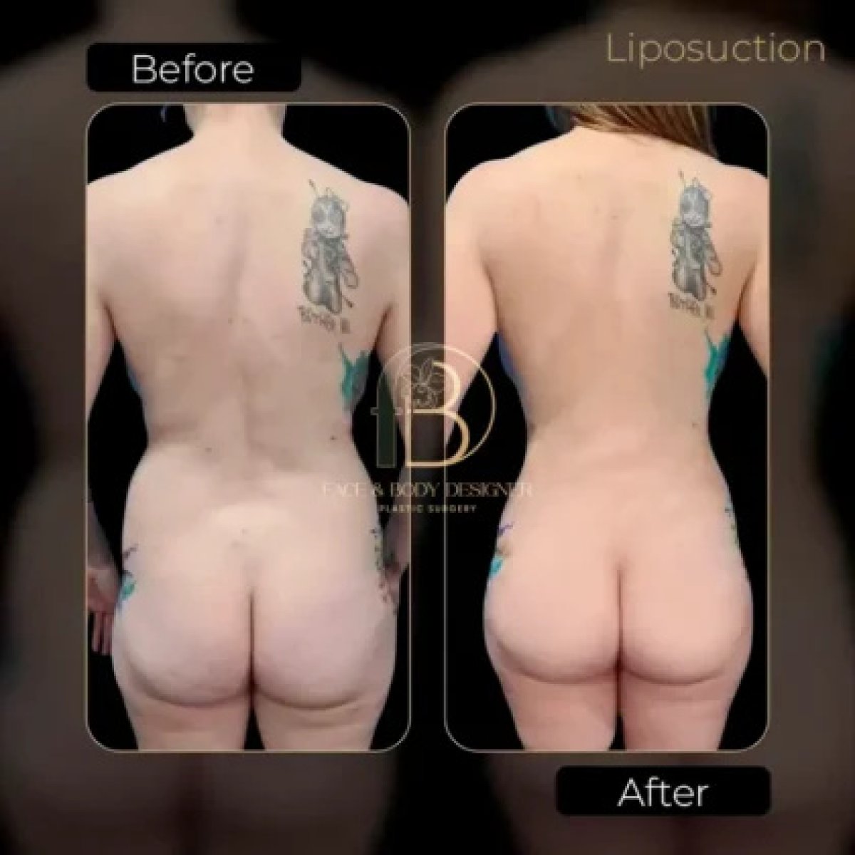 before and after photo