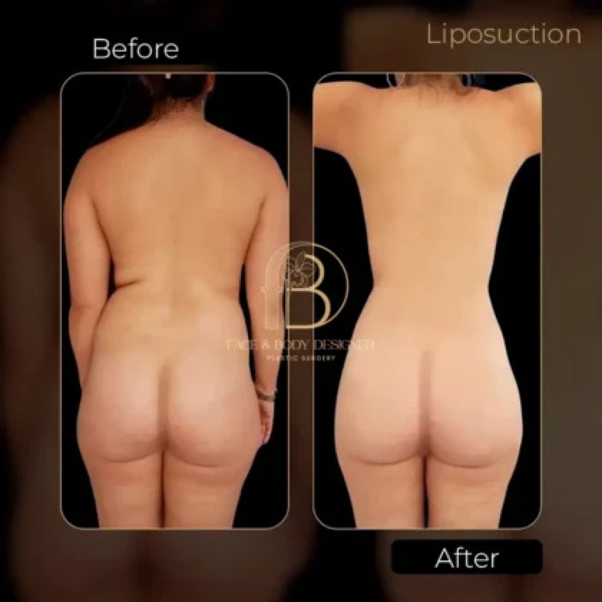 before and after photo