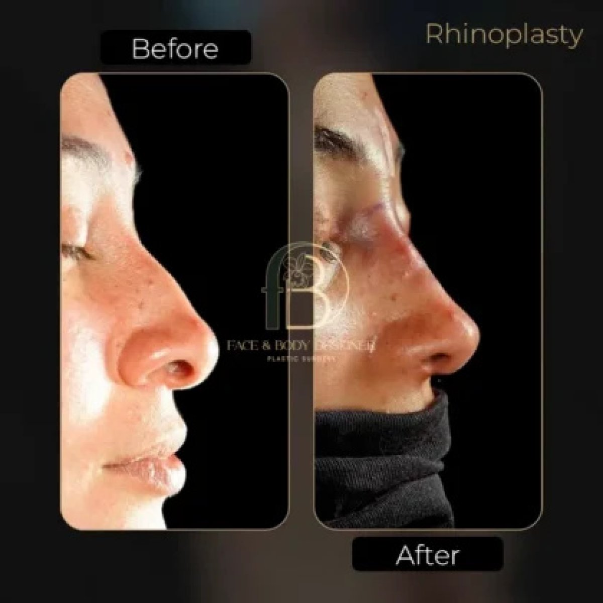before and after photo