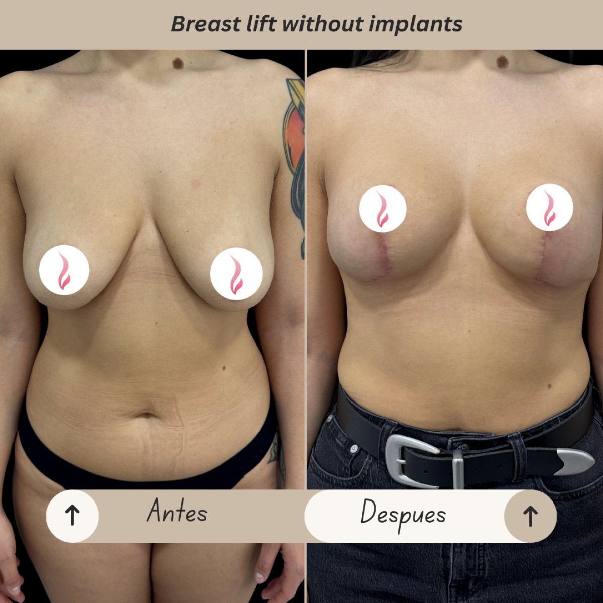 before and after photo