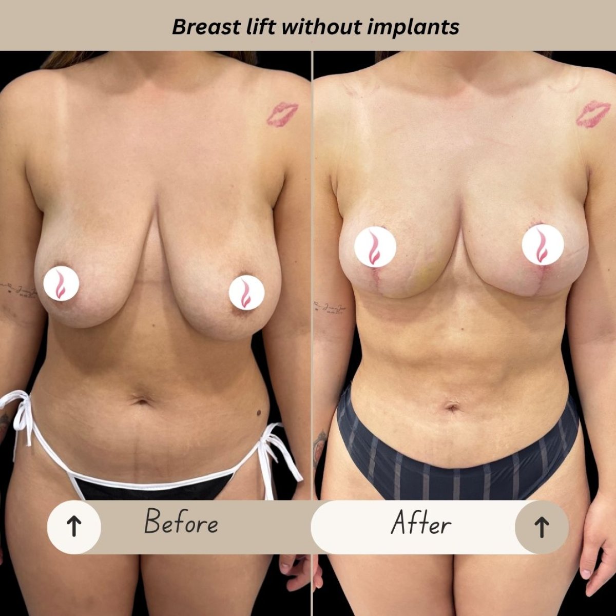 before and after photo