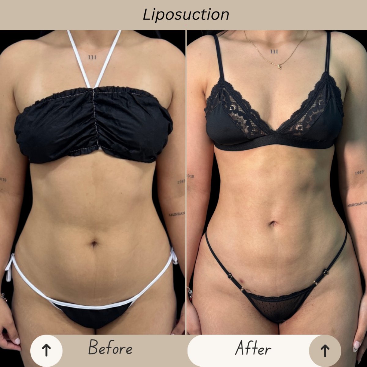before and after photo
