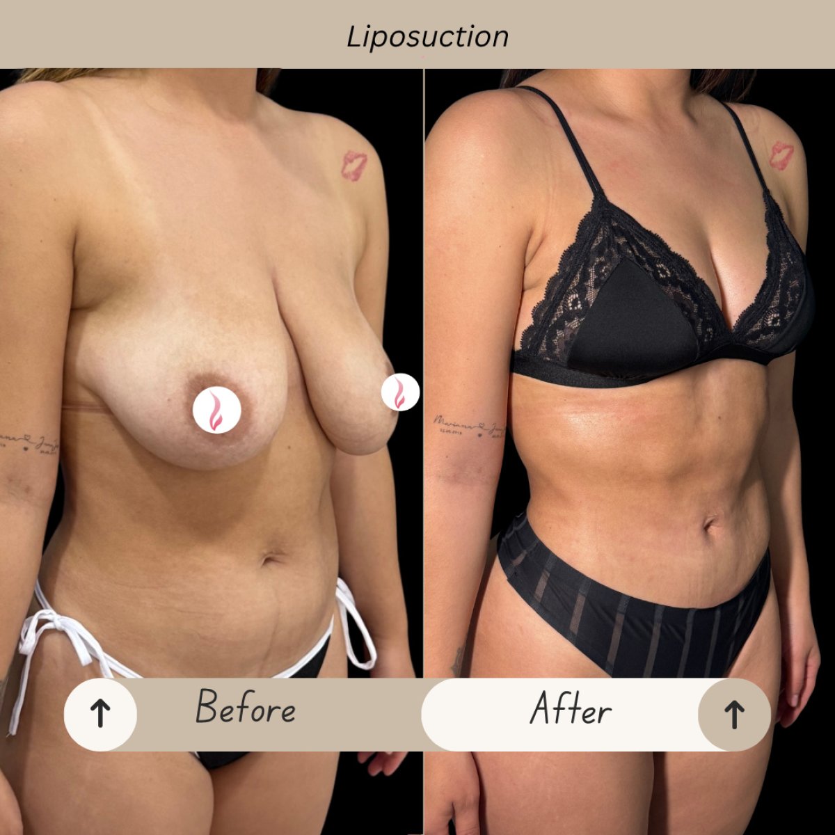 before and after photo
