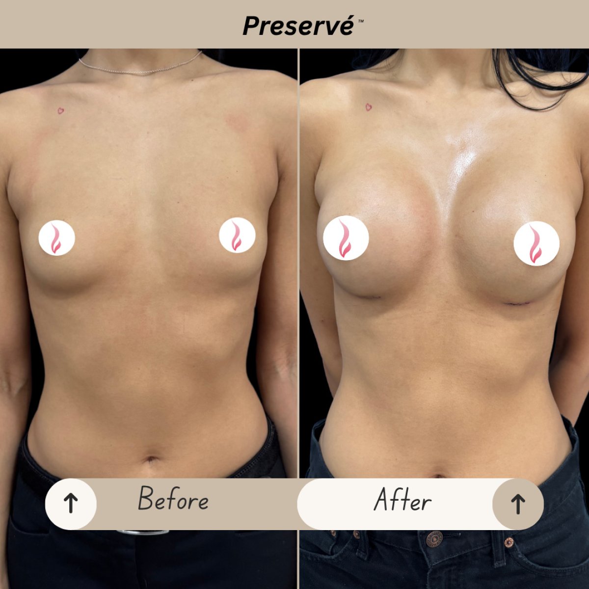 before and after photo
