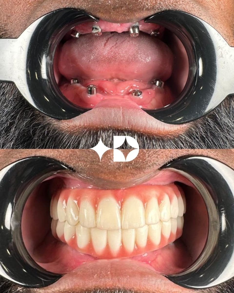 before and after photo