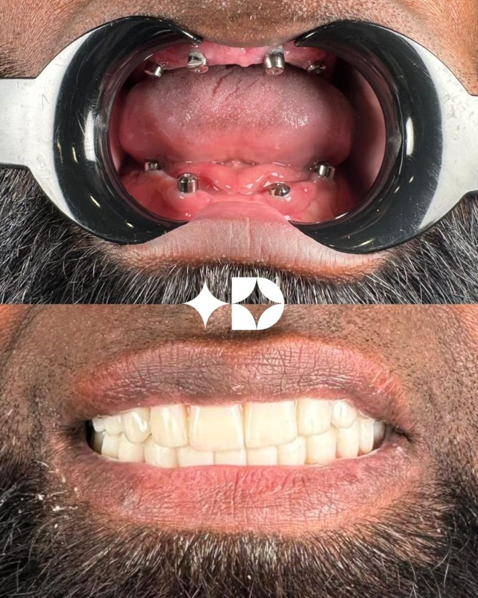 before and after photo