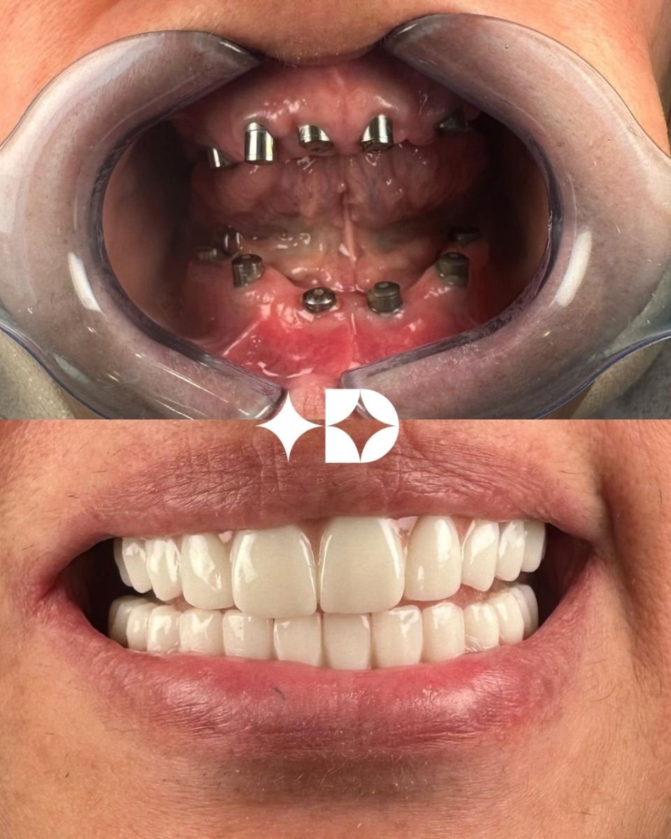 before and after photo