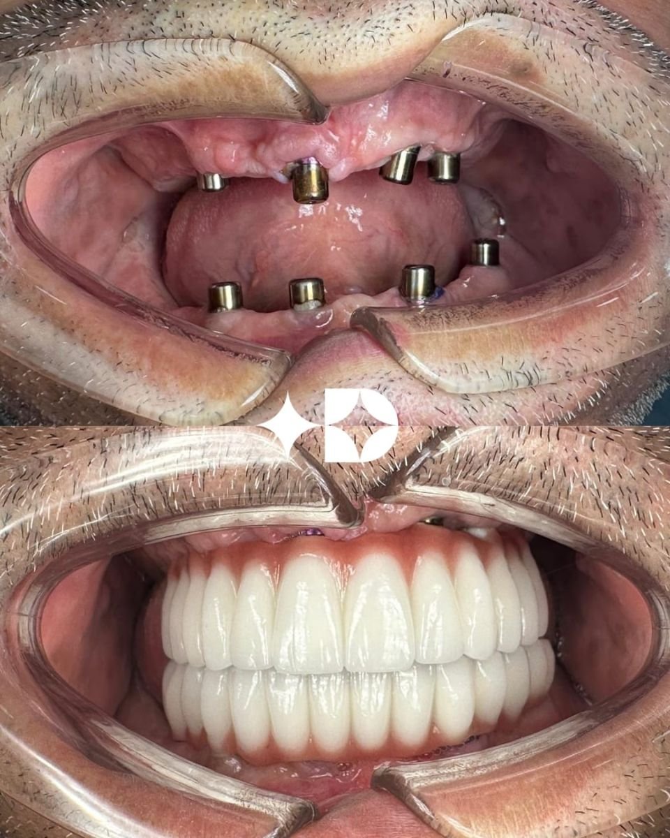 before and after photo