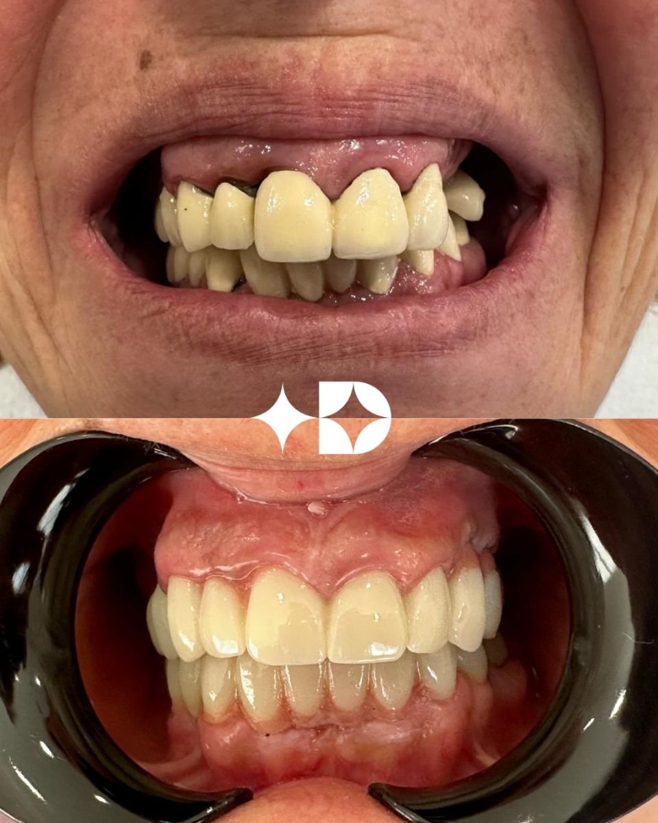 before and after photo