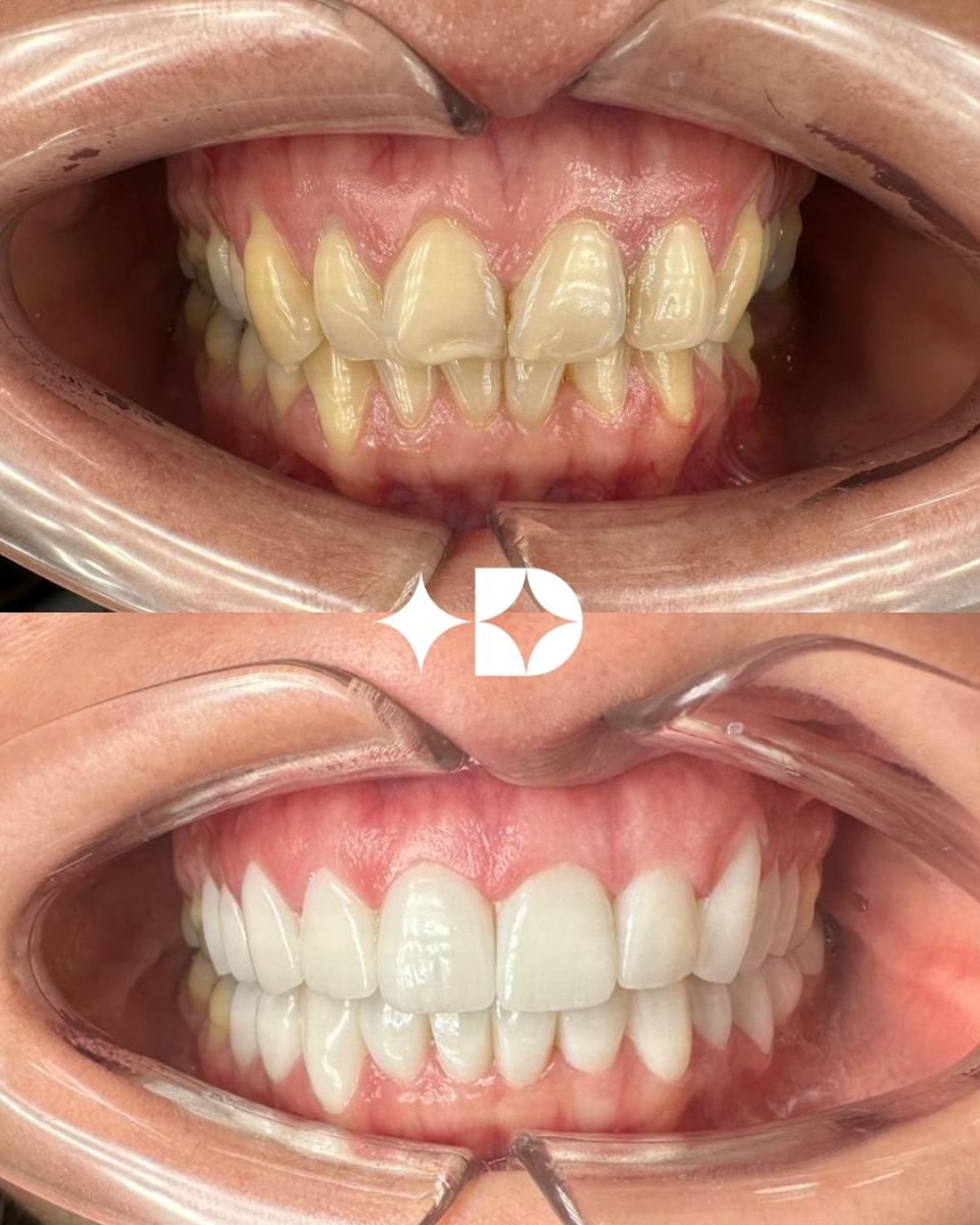 before and after photo