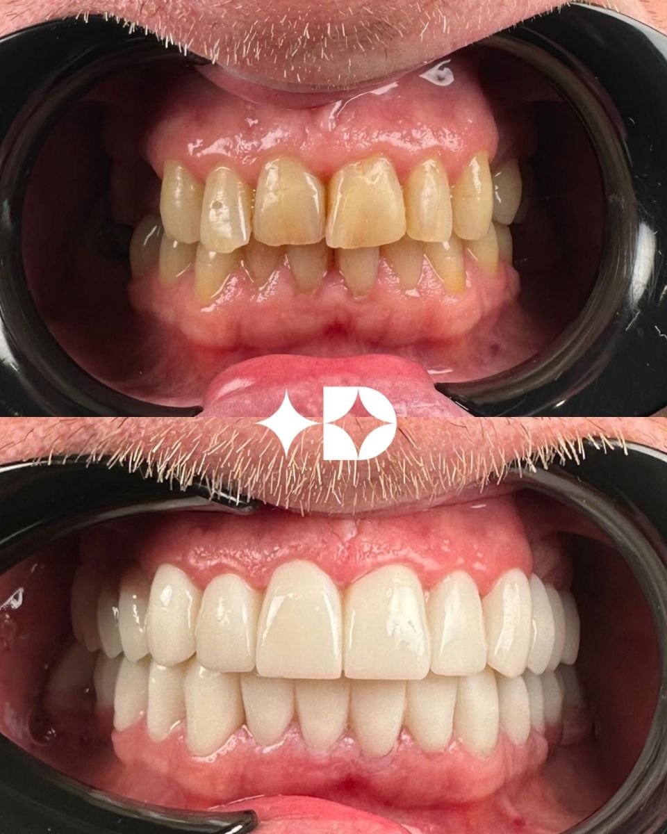 before and after photo