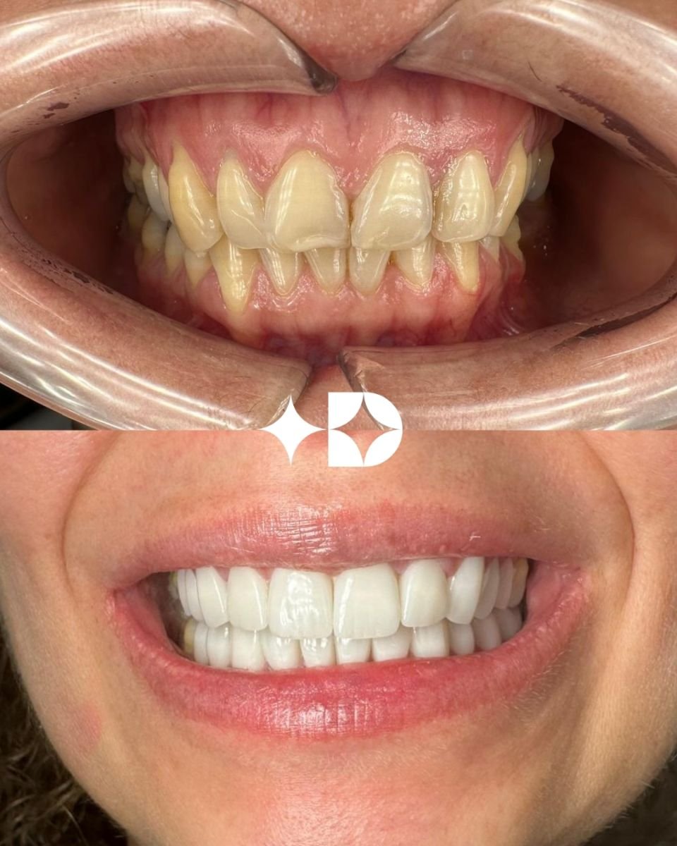 before and after photo