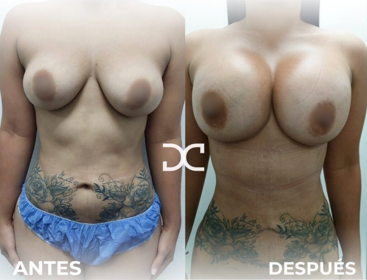 before and after photo