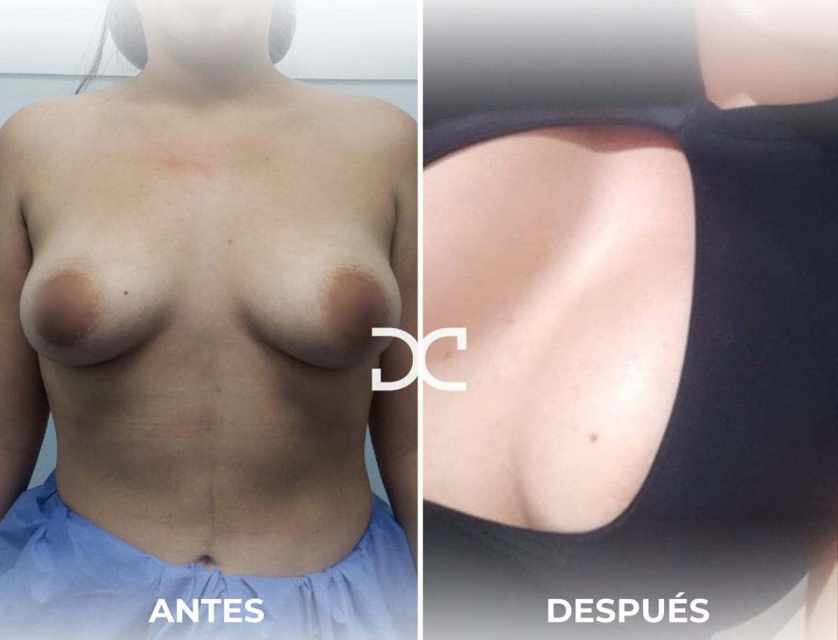 before and after photo