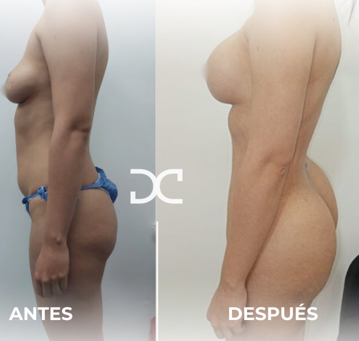 before and after photo