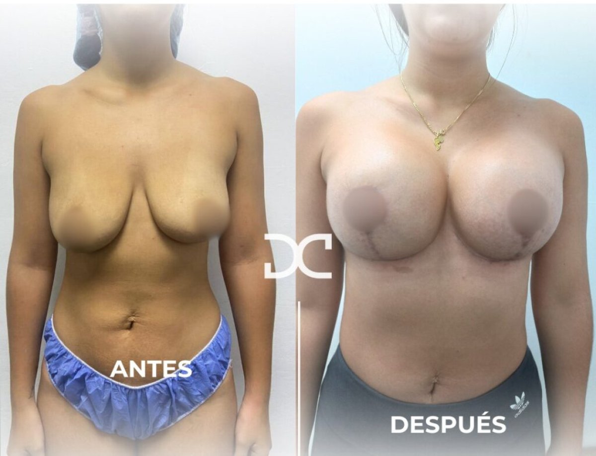 before and after photo