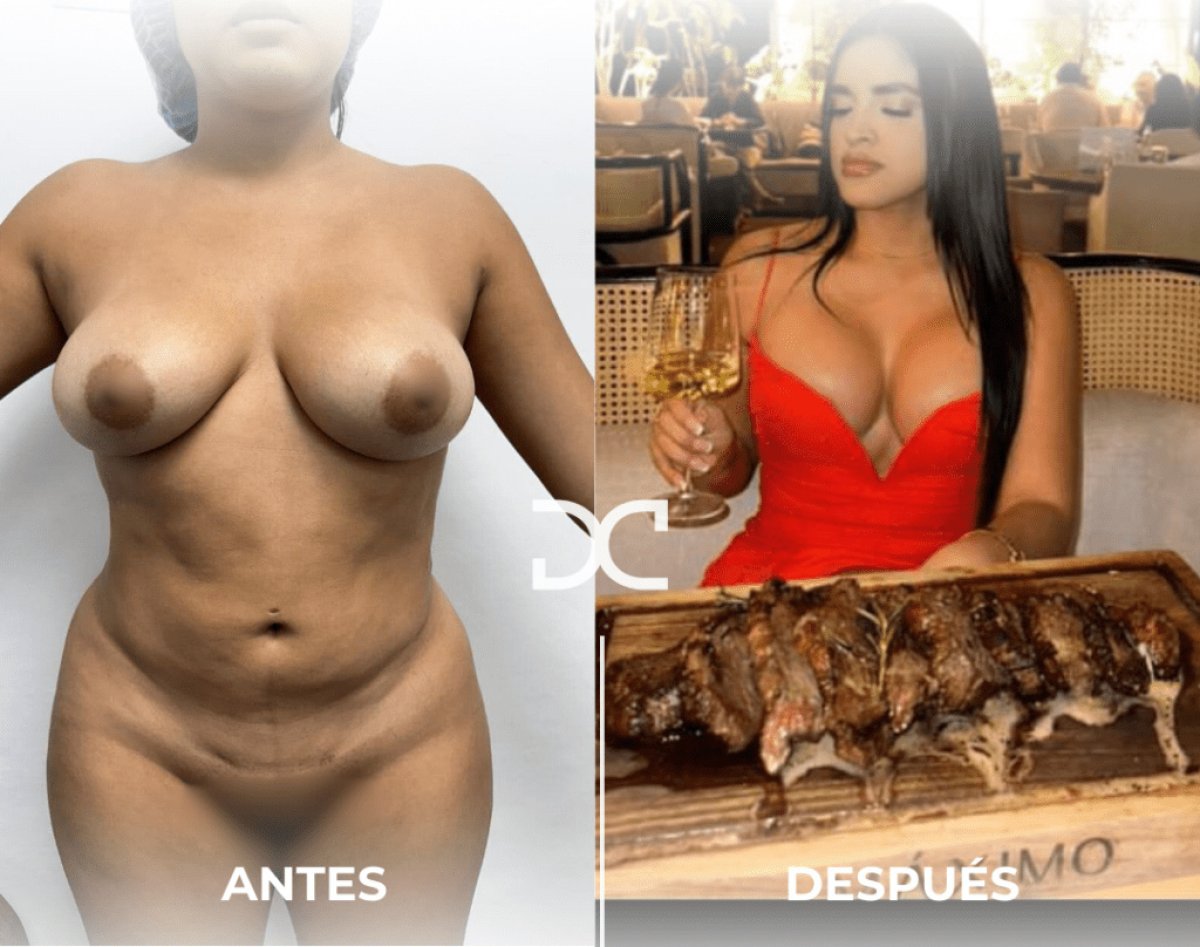 before and after photo