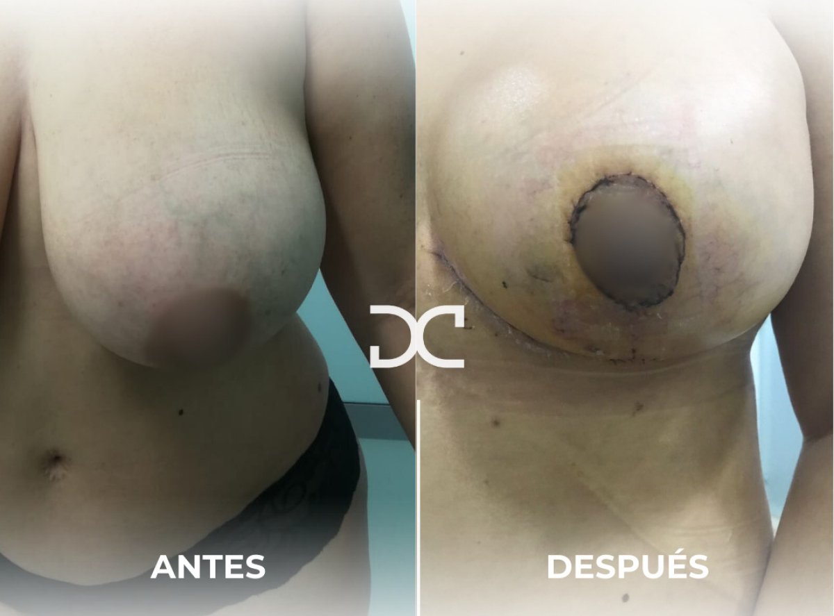 before and after photo
