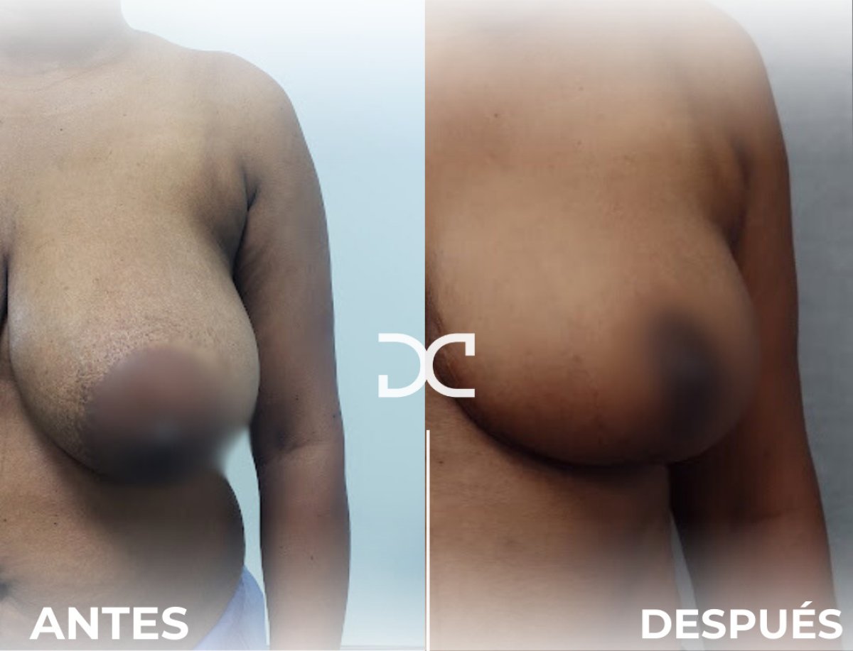 before and after photo
