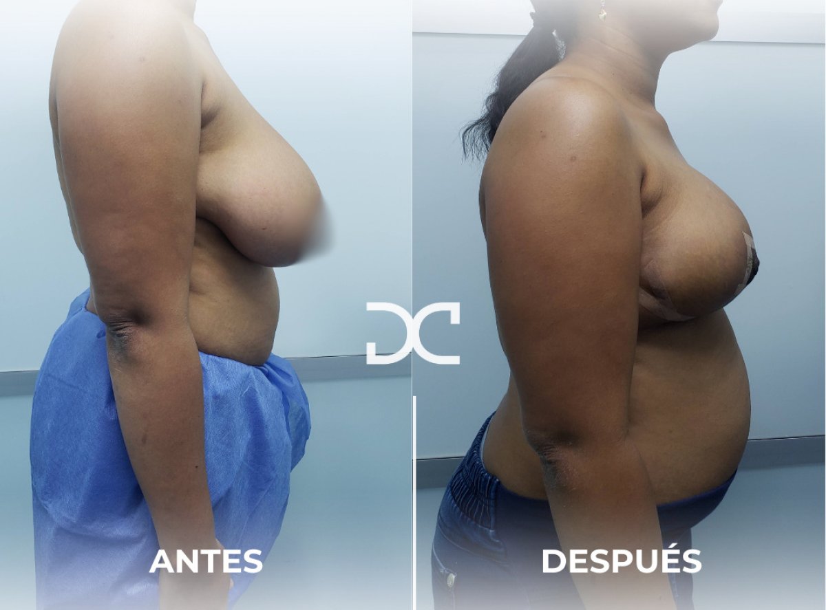before and after photo