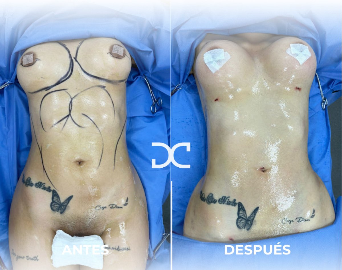 before and after photo