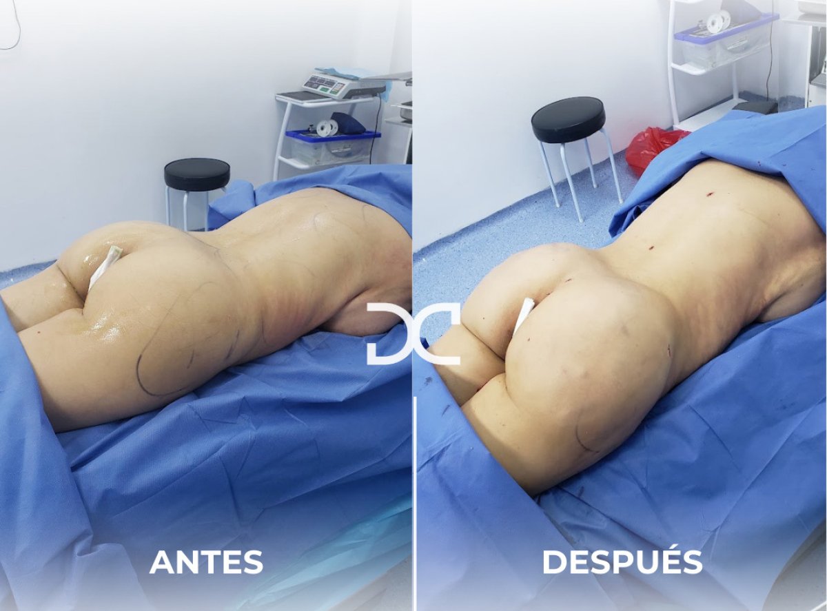 before and after photo