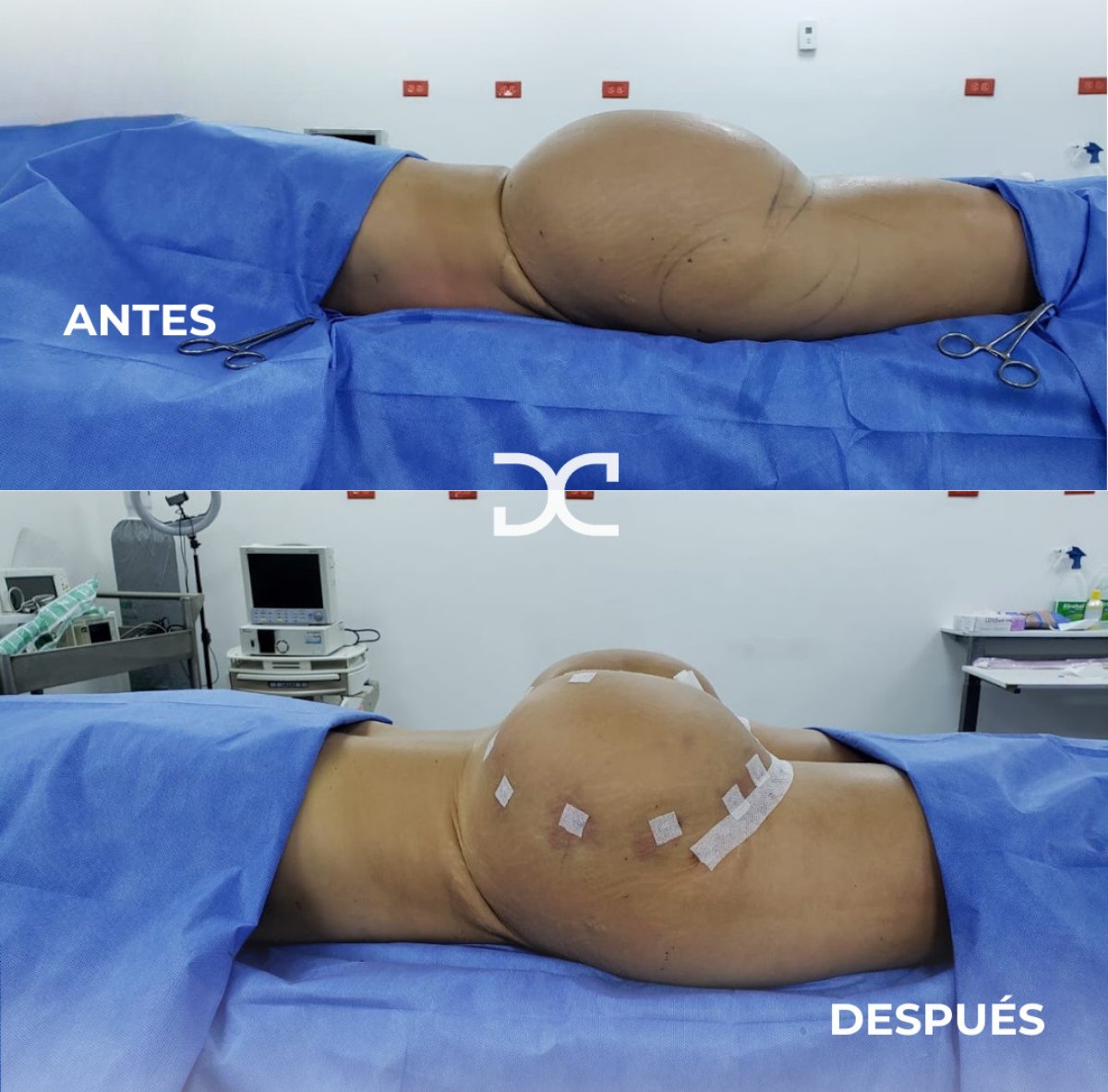 before and after photo