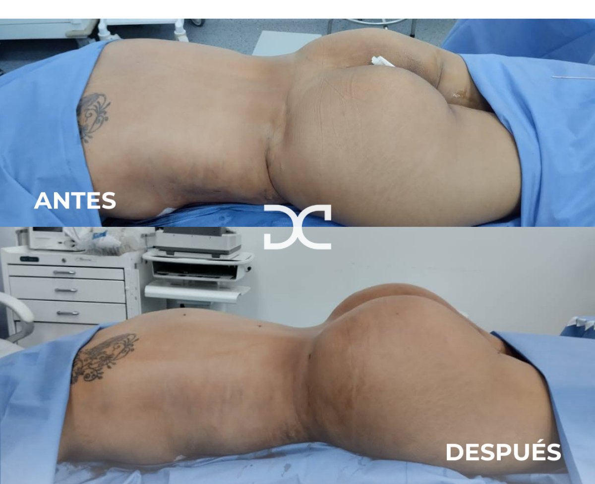 before and after photo