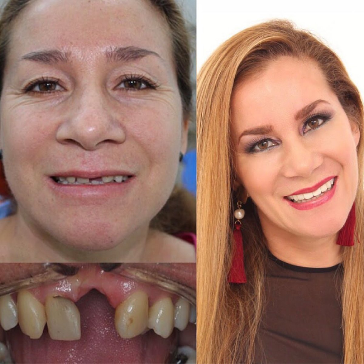 before and after photo