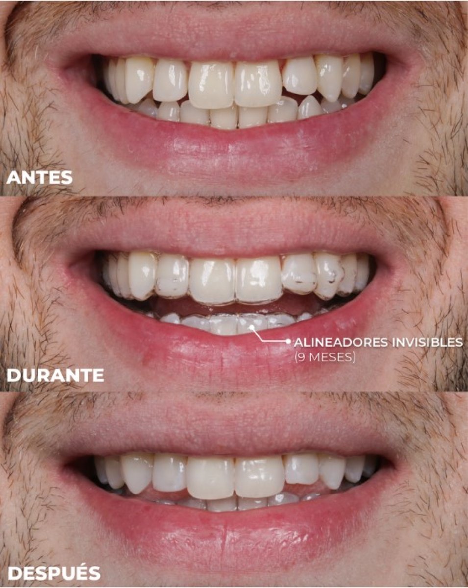 before and after photo