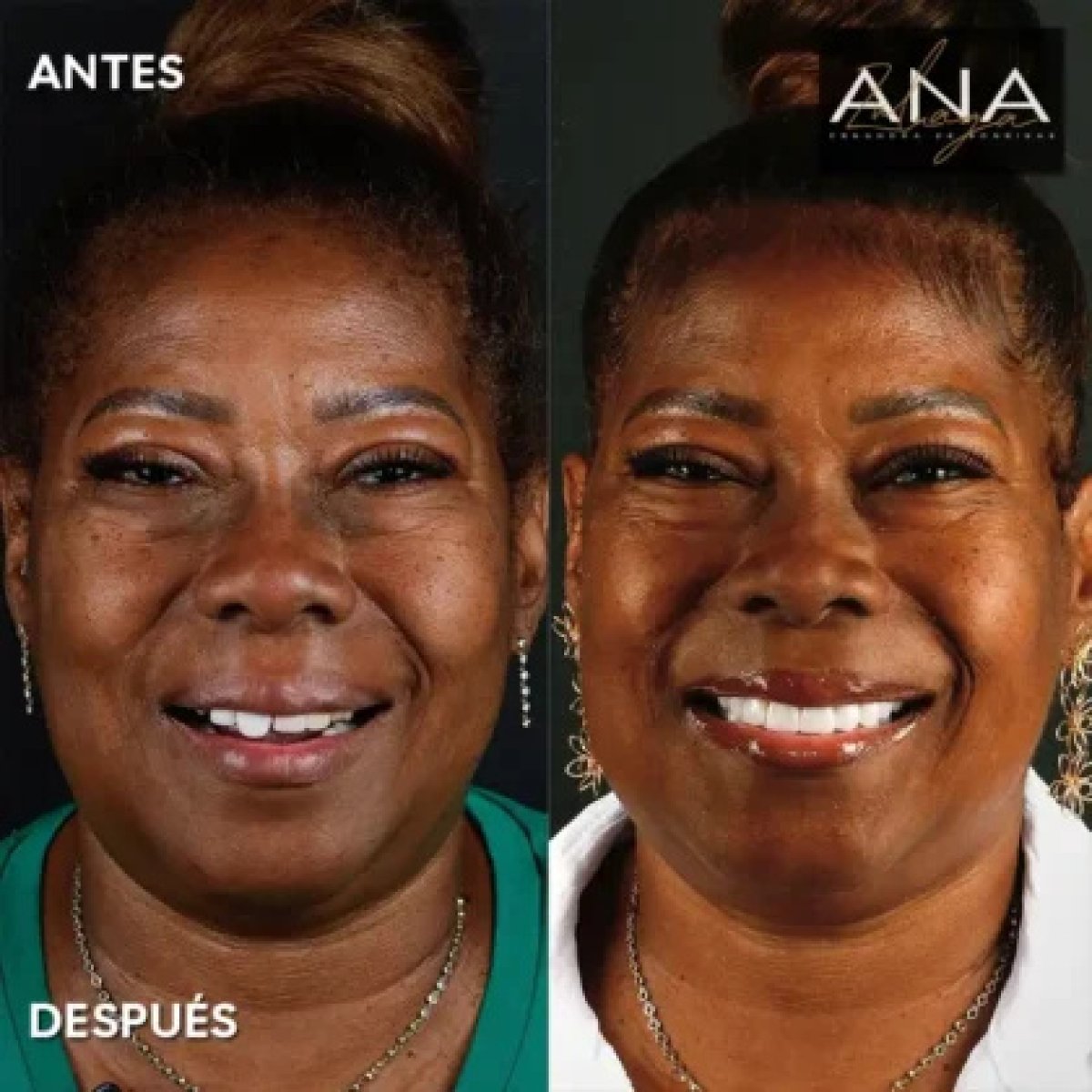 before and after photo