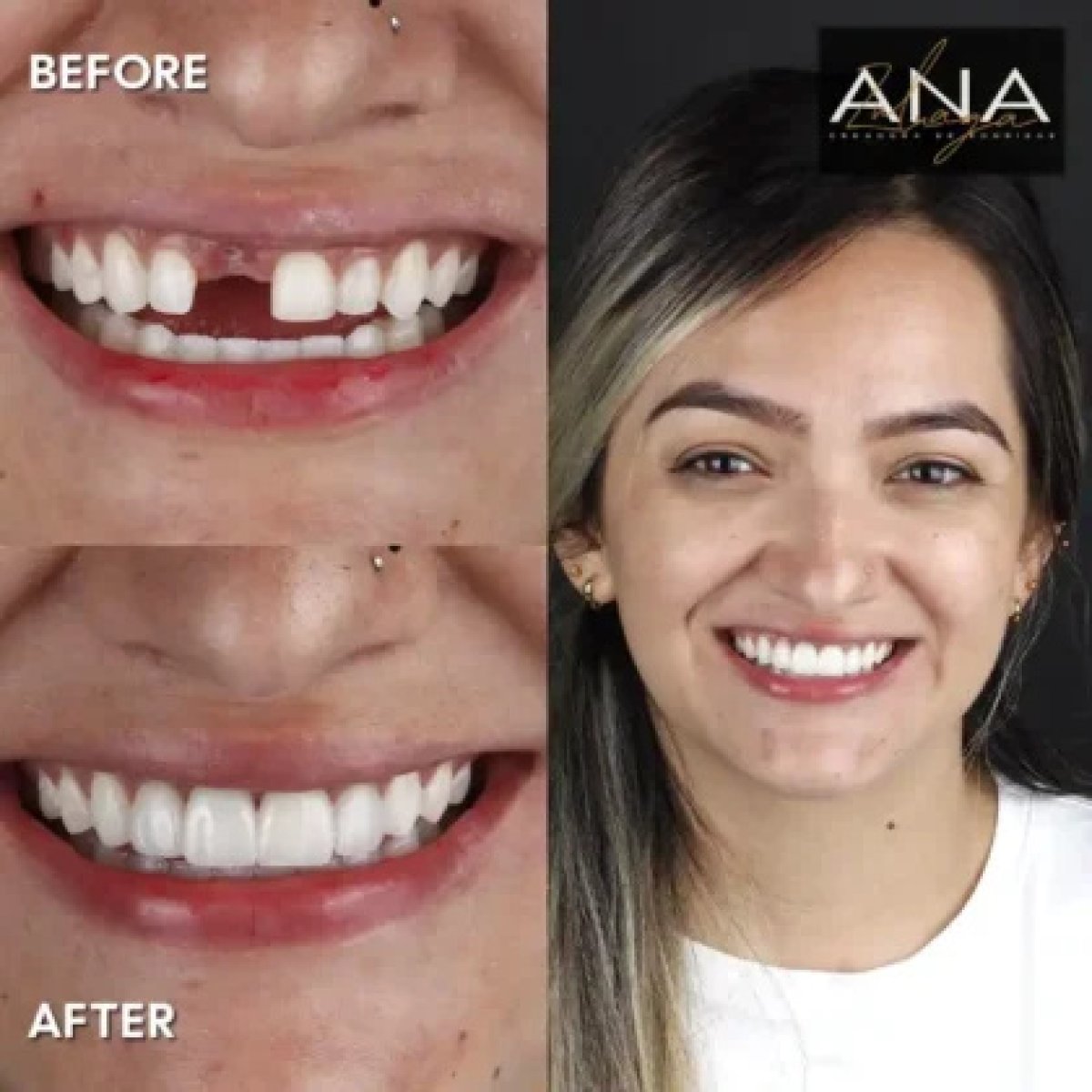 before and after photo