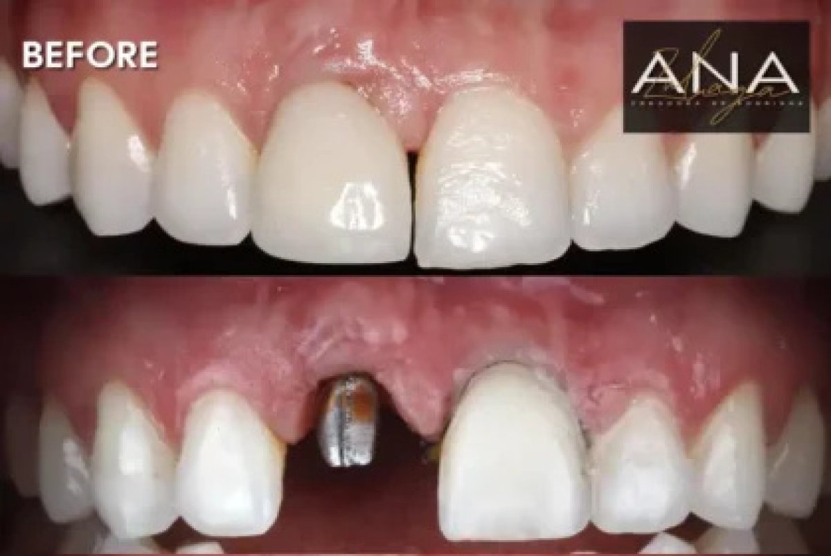 before and after photo
