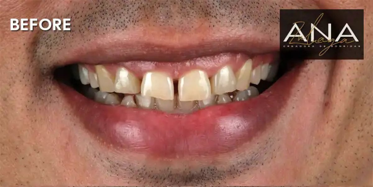before and after photo